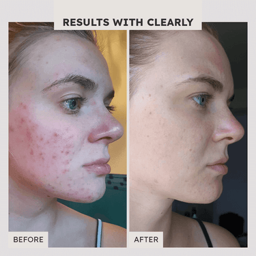 T.L.C. Essence Glow Serum - Clearly Basics